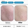 Skin Moisture IQ - Image 5
