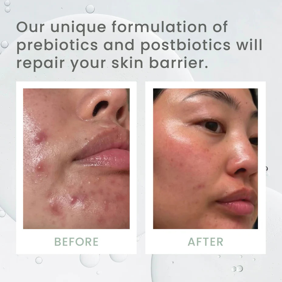 Sásta Microbiome Booster Serum - Image 9